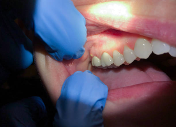 Best Cosmetic Emergency Dentistry in Orchard City, CO